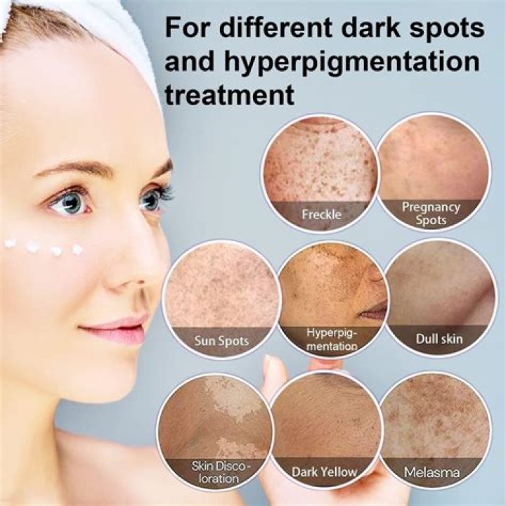 Are dark spots forever?