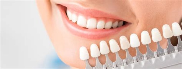 Are veneers painful to get?