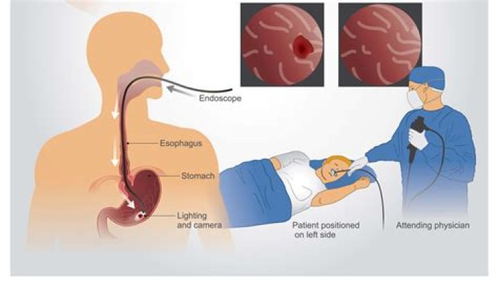 Are you awake during endometrial biopsy?
