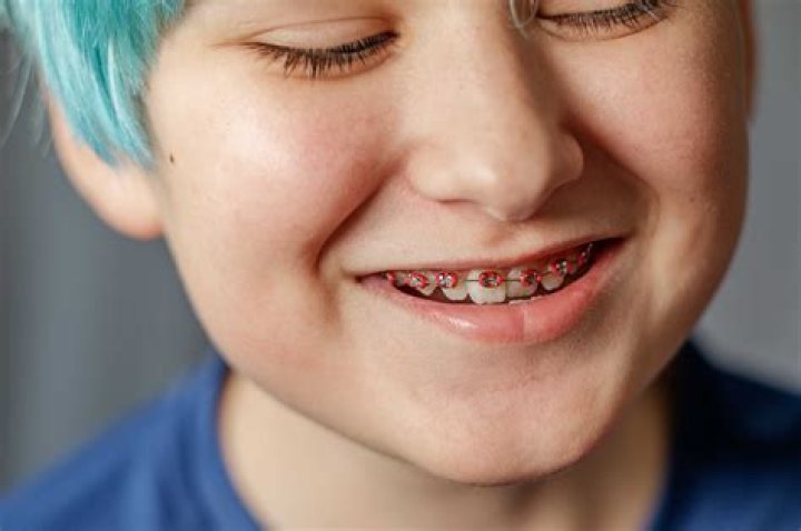 Can a 7 year old get braces?