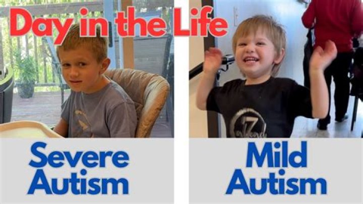 Can a child with mild autism have a normal life?