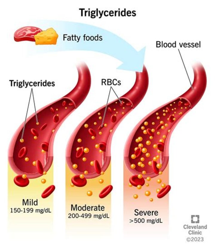 Can coffee increase triglycerides?