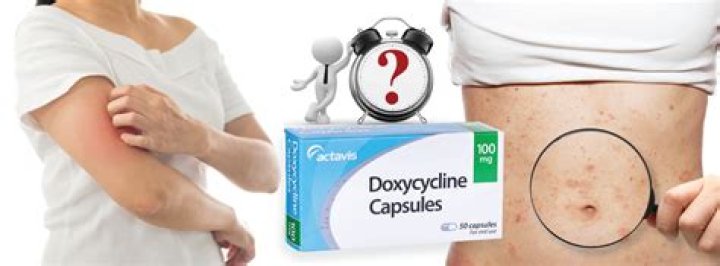 Can I go to sleep after taking doxycycline?