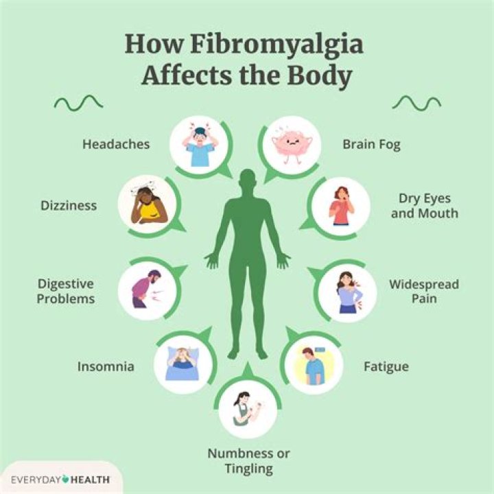Can MS be mistaken for fibromyalgia?