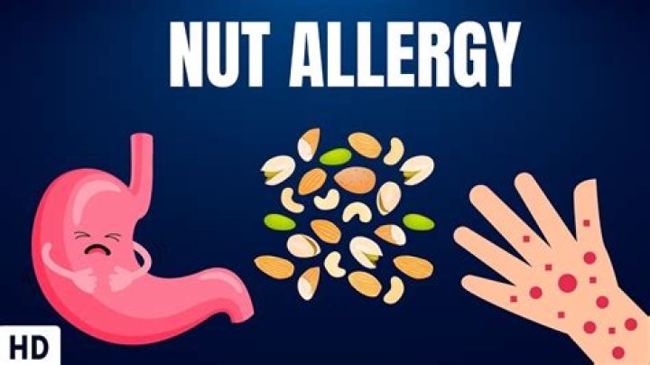Can nuts cause stomach issues?
