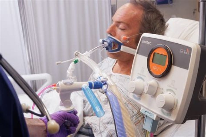Can organs fail on a ventilator?