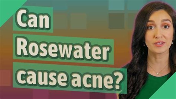 Can Rosewater cause acne?