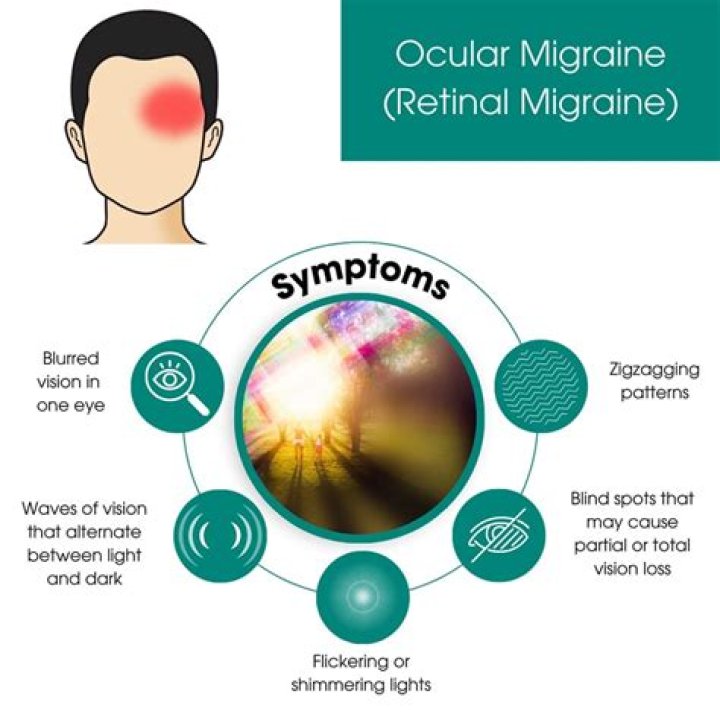 Can sinus pressure cause ocular migraines?