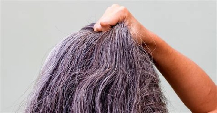 Can stress cause gray hair?