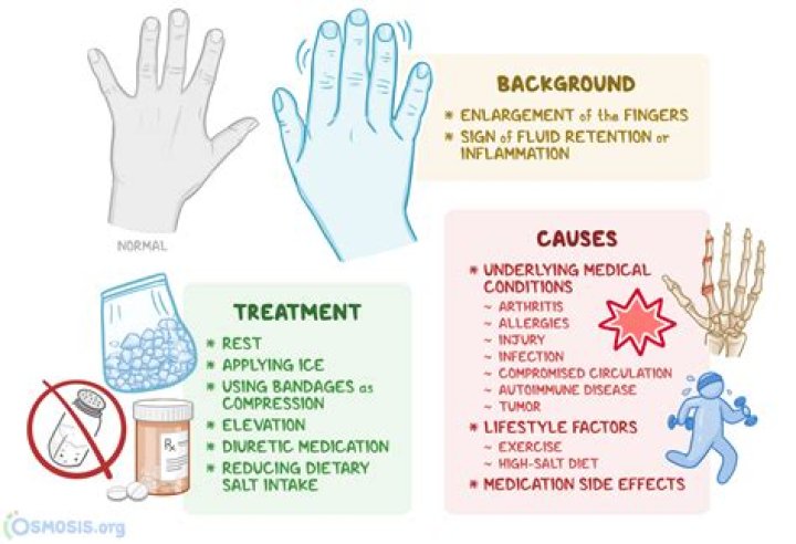 Can too much sugar cause swollen hands?