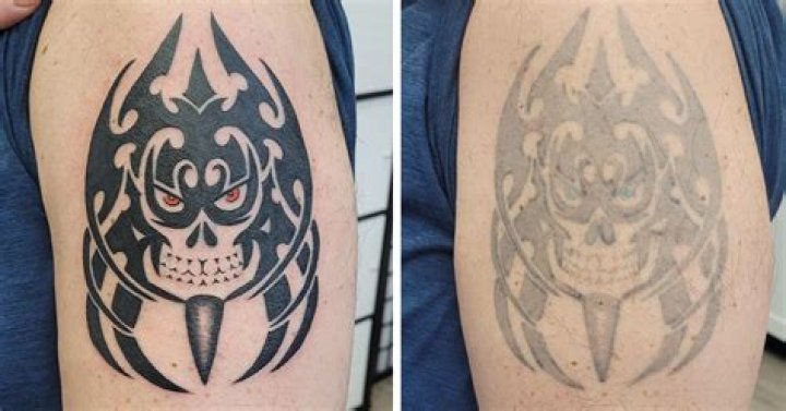 Can you damage a new tattoo?