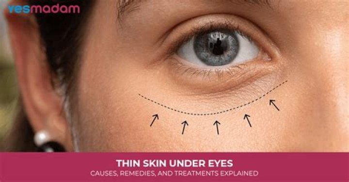 Can you thicken skin under eyes?