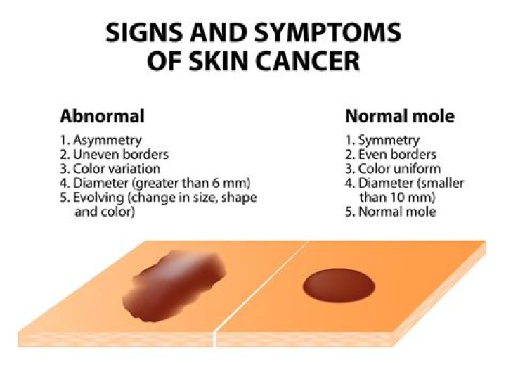 Do moles go away?