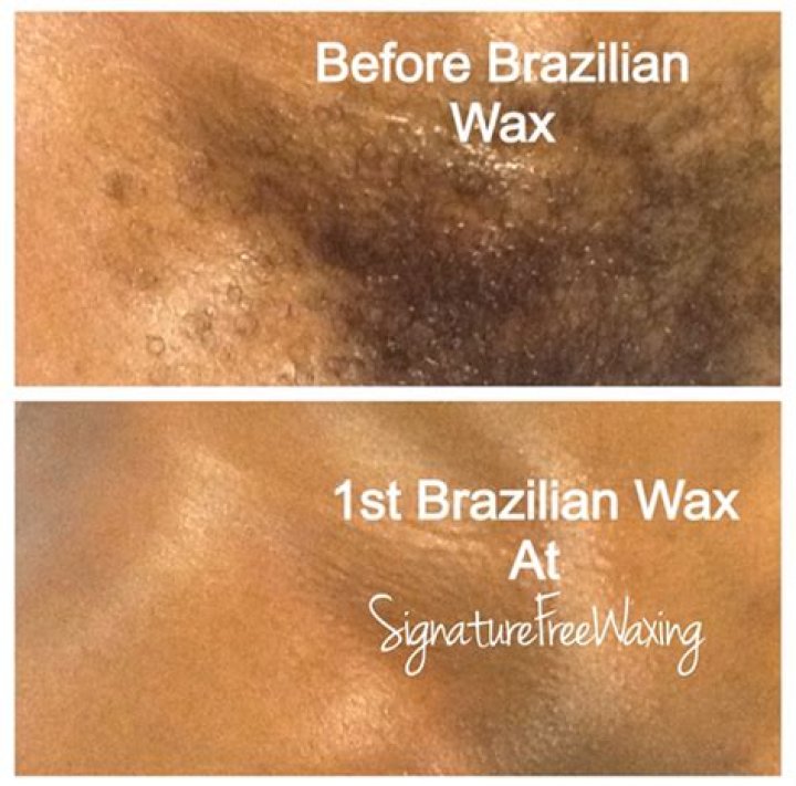 Do you have to trim before a Brazilian wax?