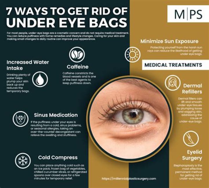 Does baking soda reduce eye bags?
