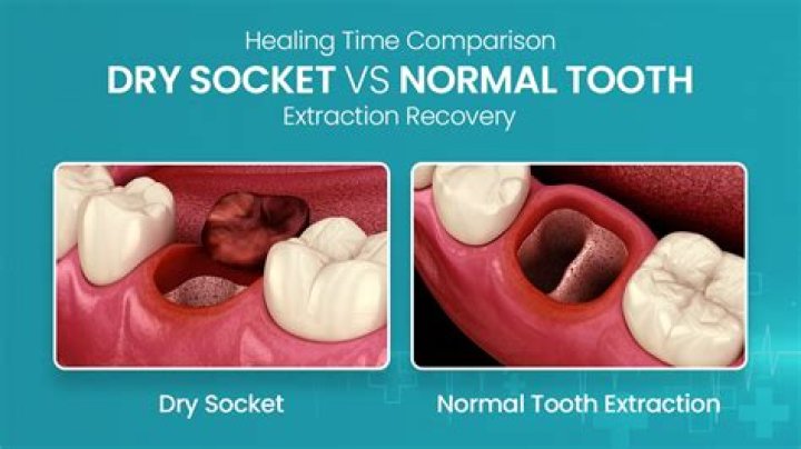 Does salt water hurt after tooth extraction?
