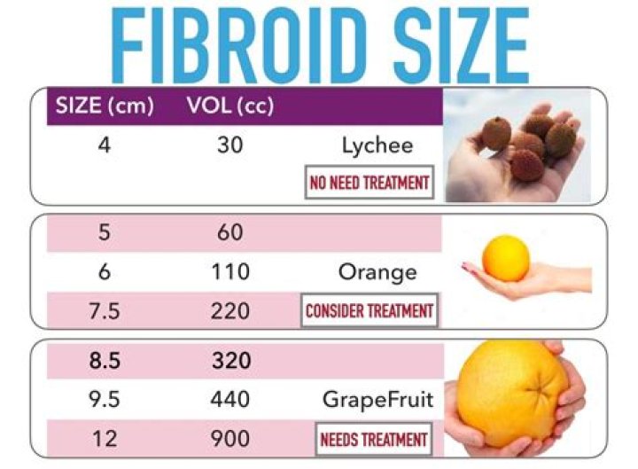 How big is a 4 cm fibroid?