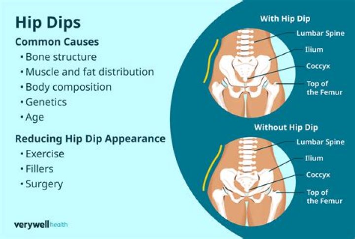 How can I get hips?