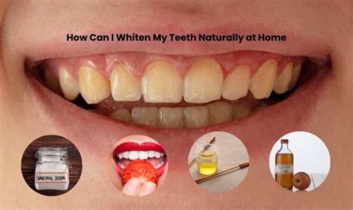 How can I whiten my teeth quickly?