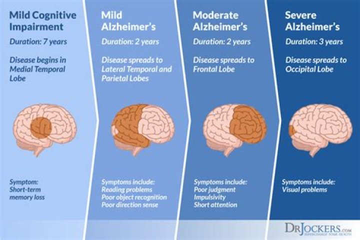 How do Alzheimers start?