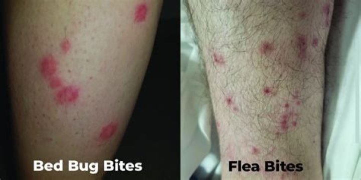 How do I know if I have bed bugs or fleas?