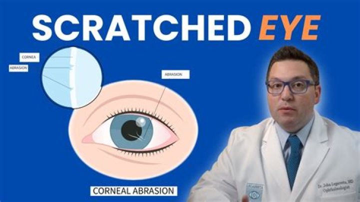 How do I know if I scratched my cornea?