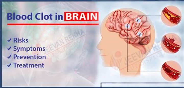 How do you get blood clot in brain?