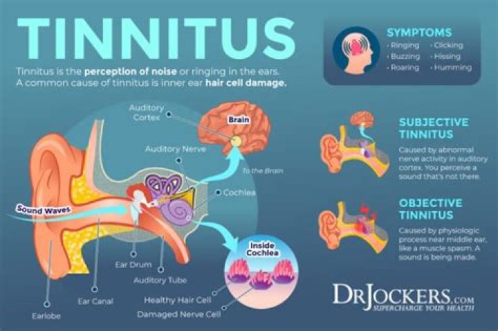 How do you know if tinnitus is temporary?