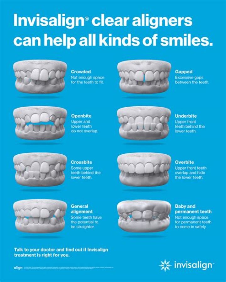 How do you make Invisalign white again?