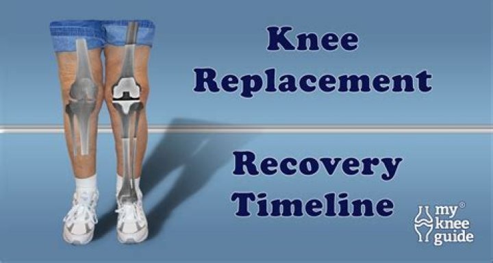 How long after knee arthroscopy can I shower?