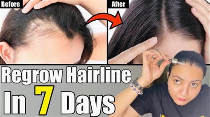 How long does castor oil take to grow hairline?