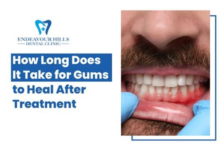 How long does it take for gums to heal after extractions for dentures?