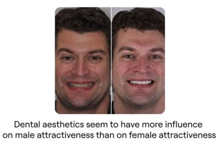 How much do teeth affect attractiveness?