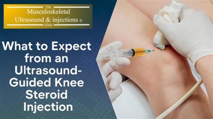 How often can I have a steroid injection in my knee?