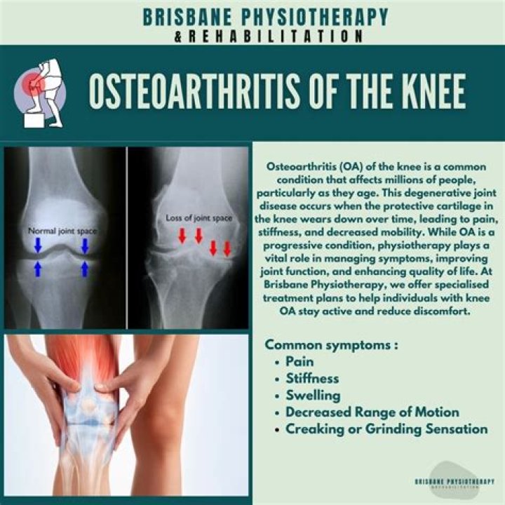 How painful is osteoarthritis of the knee?