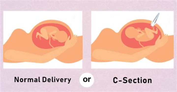 Is C-section less painful than normal delivery?
