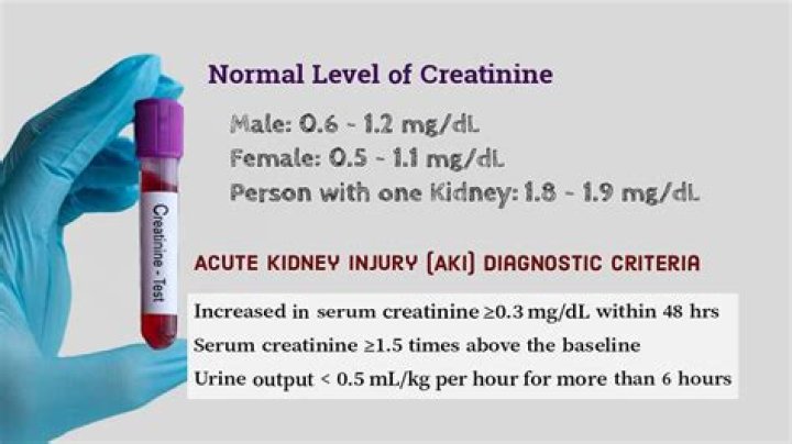 Is creatinine of 2.5 high?