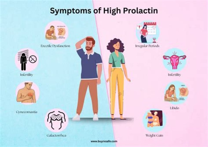 Is MRI necessary for high prolactin?