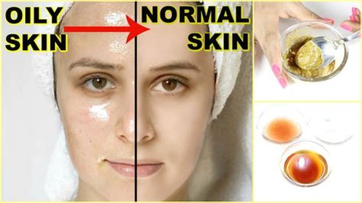 Is oily skin good?