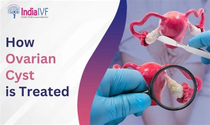 Is rice good for ovarian cyst?