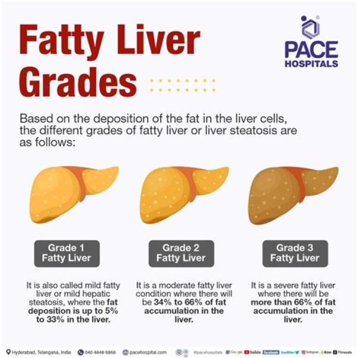Is Stage 4 fatty liver reversible?