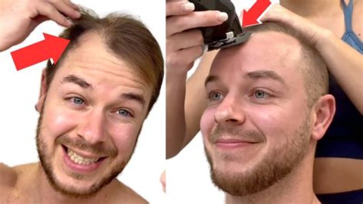 Should I cut my hair if its thinning?