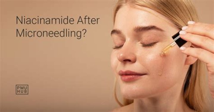 Should I use niacinamide after microneedling?