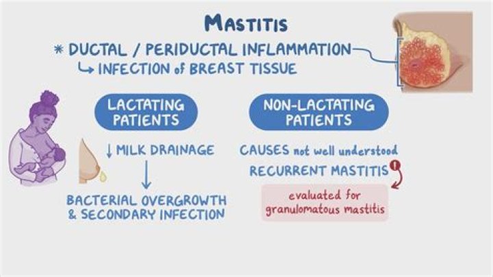 What bug causes endometritis?