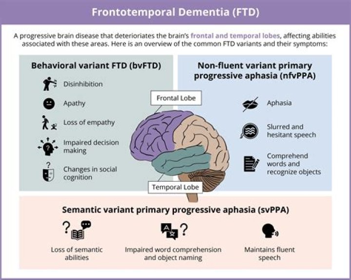 What can mimic frontotemporal dementia?