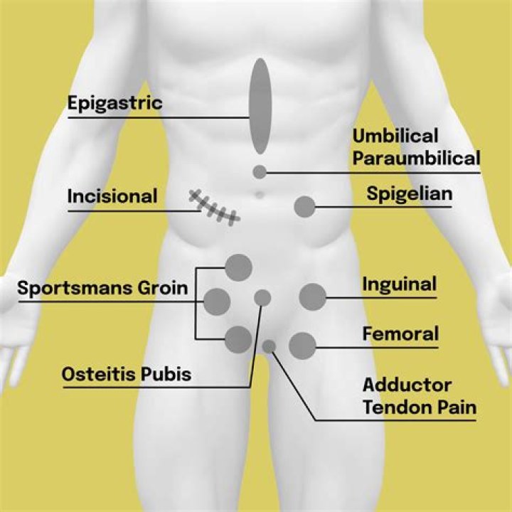 What causes a swollen mons pubis?