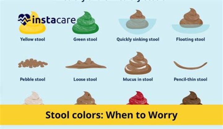 What color is stool with pancreatitis?
