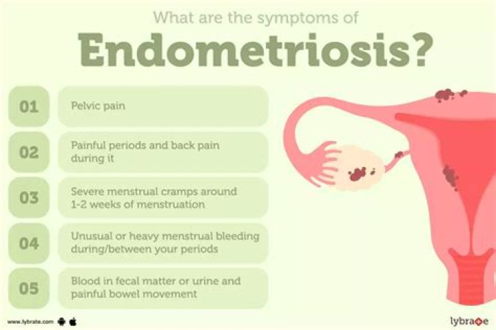 What does early endometriosis feel like?