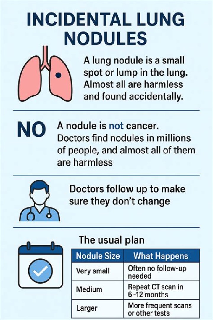 What does it mean when a doctor says you have a nodule on your lung?