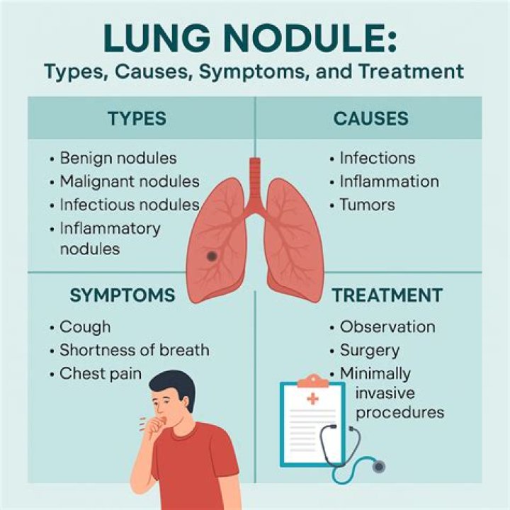 What infections cause lung nodules?